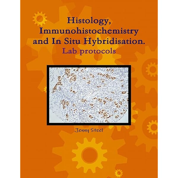 Diagnostic Immunohistochemistry: Theranostic and Genomic